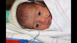 Orogastric Tube